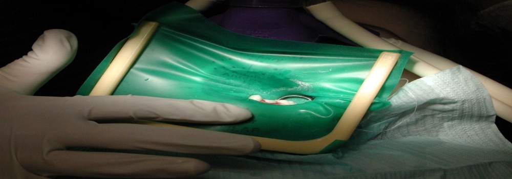 banner of doctor holding green cover and endodontic in it