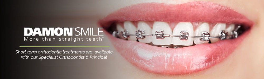 banner with smiling teeth showing of a girl with written about orthodontic treatment and orthodontist