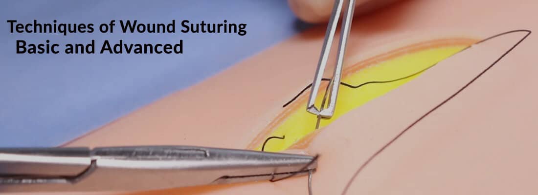 showing suture suturing with forceps and tweezers