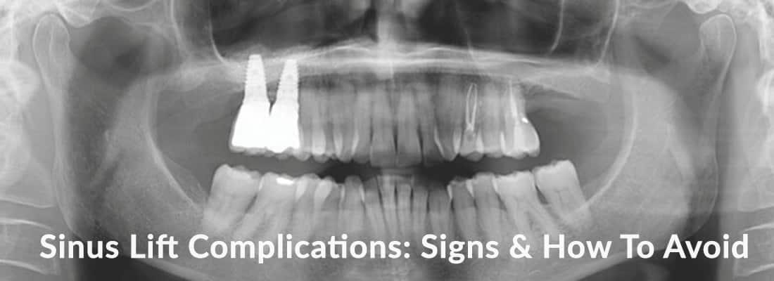banner with x-ray of teeth